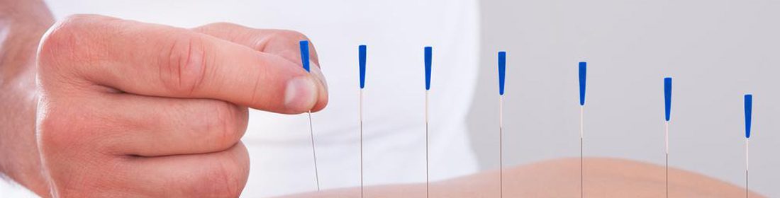 acupuncture treatment 1100x280 - Ivybridge Physio and Rehab Treatment